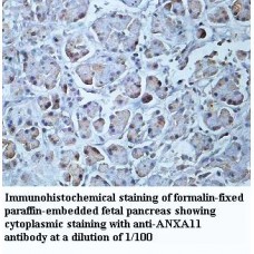 Annexin A11 Antibody