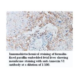 Annexin VI Antibody
