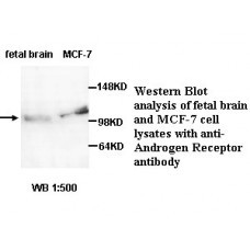  Androgen Receptor Antibody