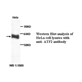 ATF2 Antibody