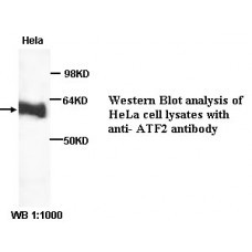 ATF2 Antibody