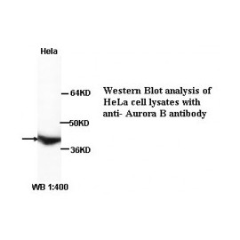 Aurora B Antibody