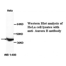 Aurora B Antibody