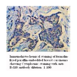 BCL10 Antibody