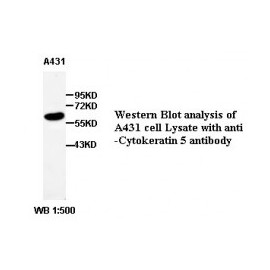 Cytokeratin 5 Antibody