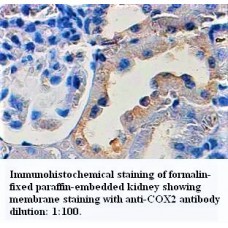 COX2 Antibody