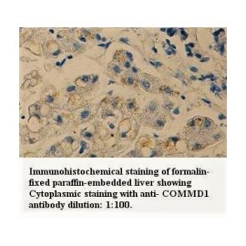 COMMD1 Antibody