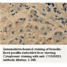 COMMD1 Antibody