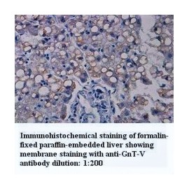 GnT-V Antibody
