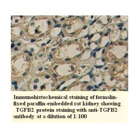 TGFB2 Antibody