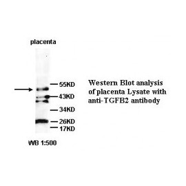 TGFB2 Antibody