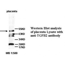 TGFB2 Antibody