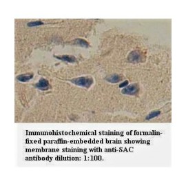 SAC Antibody