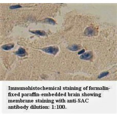 SAC Antibody