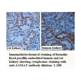 AGMAT Antibody