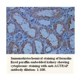 AGTRAP Antibody