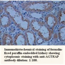 AGTRAP Antibody