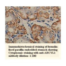 AHCYL1 Antibody