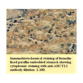 AHCYL1 Antibody
