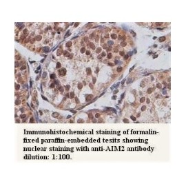 AIM2 Antibody