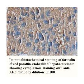 AK2 Antibody