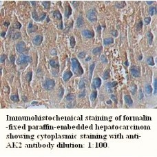 AK2 Antibody