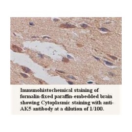 AK5 Antibody