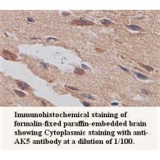 AK5 Antibody