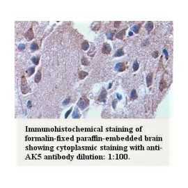 AK5 Antibody