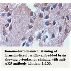 AK5 Antibody