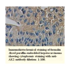 AK2 Antibody
