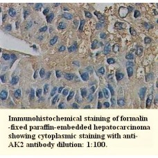 AK2 Antibody