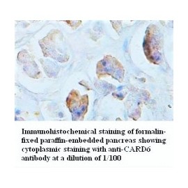 CARD6 Antibody