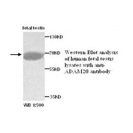 ADAM20 Antibody