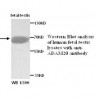 ADAM20 Antibody