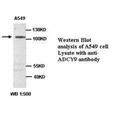 ADCY9 Antibody