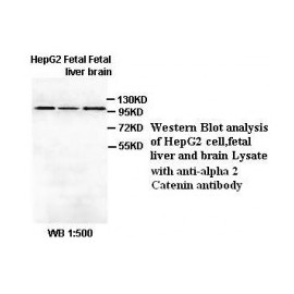 Alpha 2 Catenin Antibody