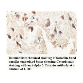 Alpha 2 Catenin Antibody