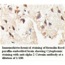 Alpha 2 Catenin Antibody