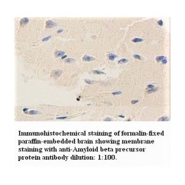 Amyloid Beta A4 Protein Antibody