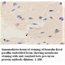 Amyloid Beta A4 Protein Antibody