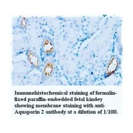 Aquaporin2 Antibody