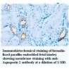Aquaporin2 Antibody