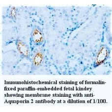 Aquaporin2 Antibody