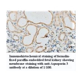 Aquaporin3 Antibody
