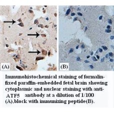 ATF5 Antibody
