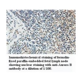 Aurora B Antibody
