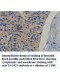 TAOK3 Antibody