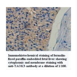 TAOK3 Antibody