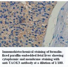 TAOK3 Antibody